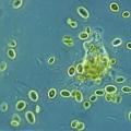 De pseudopoden van protozoa zijn plastiden